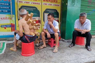 拔火罐