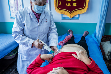 Z38568-2-277263-135****8708-《传承非遗“针”情脉脉》组02【针灸放血疗法、治疗带状疱疹】胡济修135****8708.摄于2025年3月17日北京同仁堂承德中医医院针灸科。_DSC0266.jpghu.jpg
