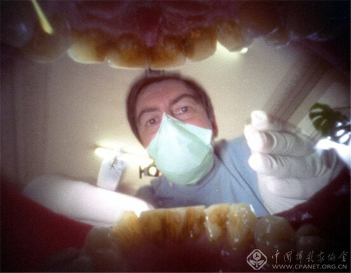 摄影师发明口腔相机 张口即拍